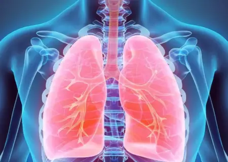  چگونه می‌توان سرطان ریه را زود تشخیص داد و درمان شد؟